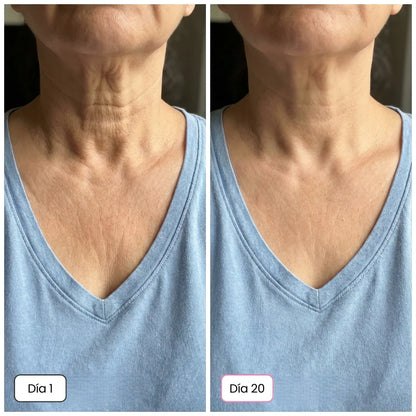 Escultor Lifting Facial 7 en 1 | CollagenLigth Pro™