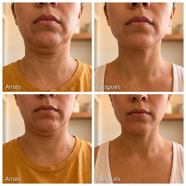 Verónica R., 47