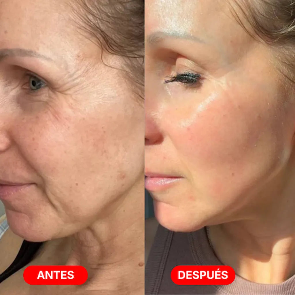 Escultor Lifting Facial 7 en 1 | CollagenLigth Pro™