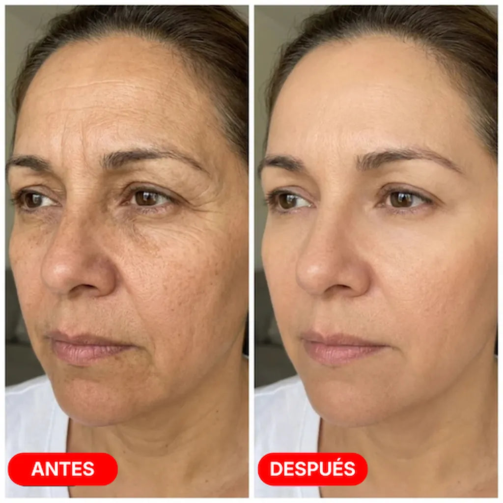 Escultor Lifting Facial 7 en 1 | CollagenLigth Pro™