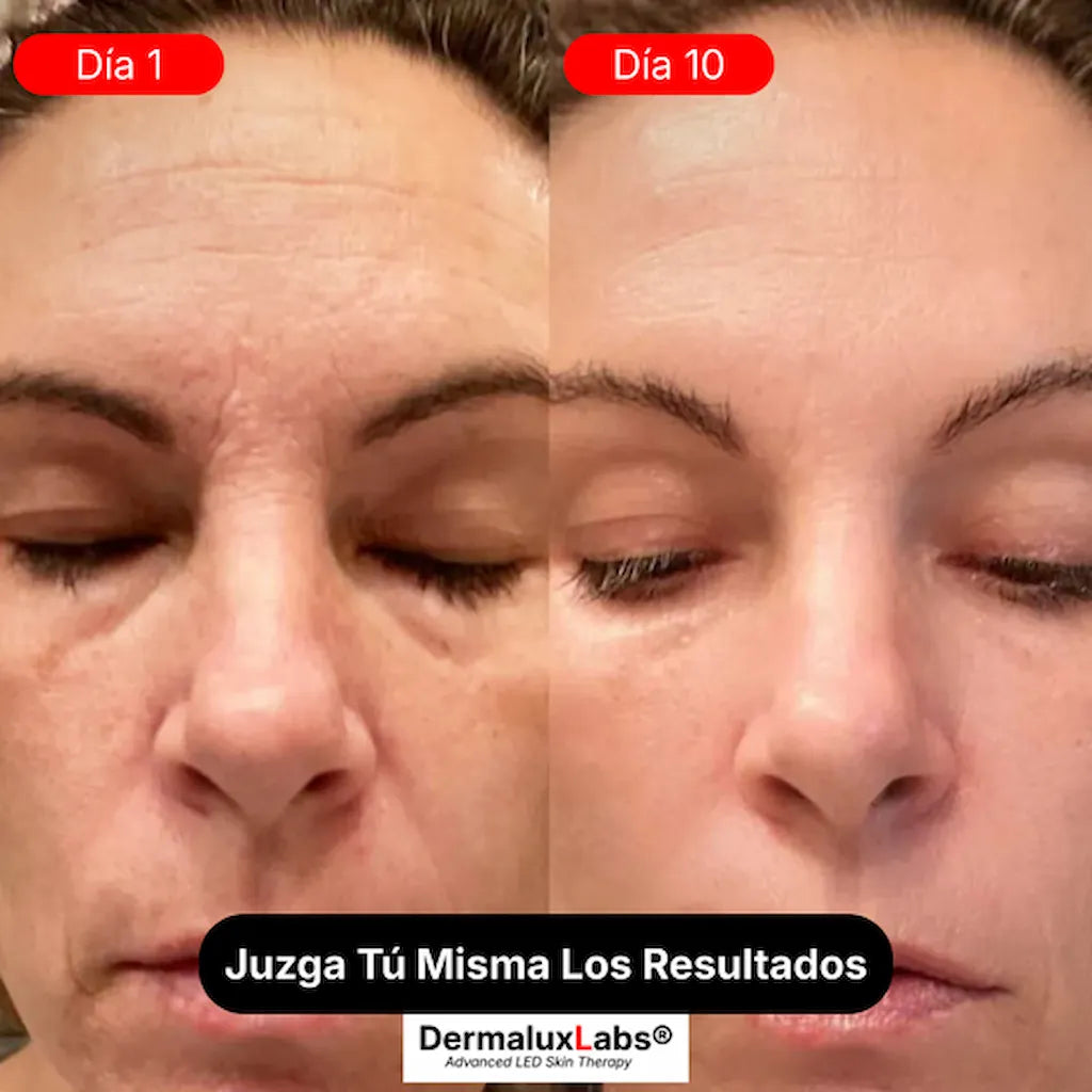 Escultor Lifting Facial 7 en 1 | CollagenLigth Pro™