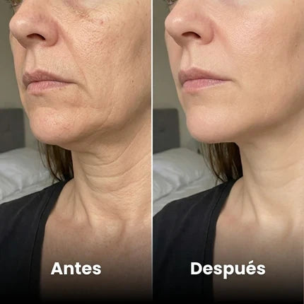 Escultor Lifting Facial 7 en 1 | CollagenLigth Pro™