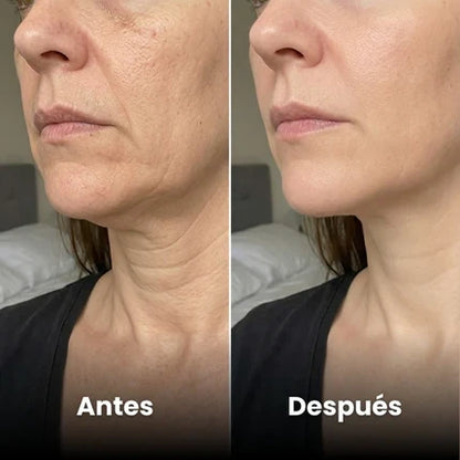 Escultor Lifting Facial 7 en 1 | CollagenLigth Pro™